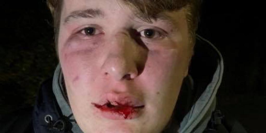 Toegetakelde Joep (17) uit Wijnandsrade: Heb een vermoeden